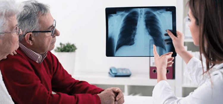 rak płuca leczenie