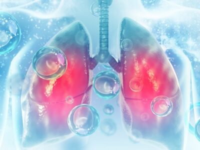 Aktualne wyzwania w diagnostyce i leczeniu raka płuca w Polsce