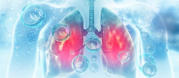 Aktualne wyzwania w diagnostyce i leczeniu raka płuca w Polsce